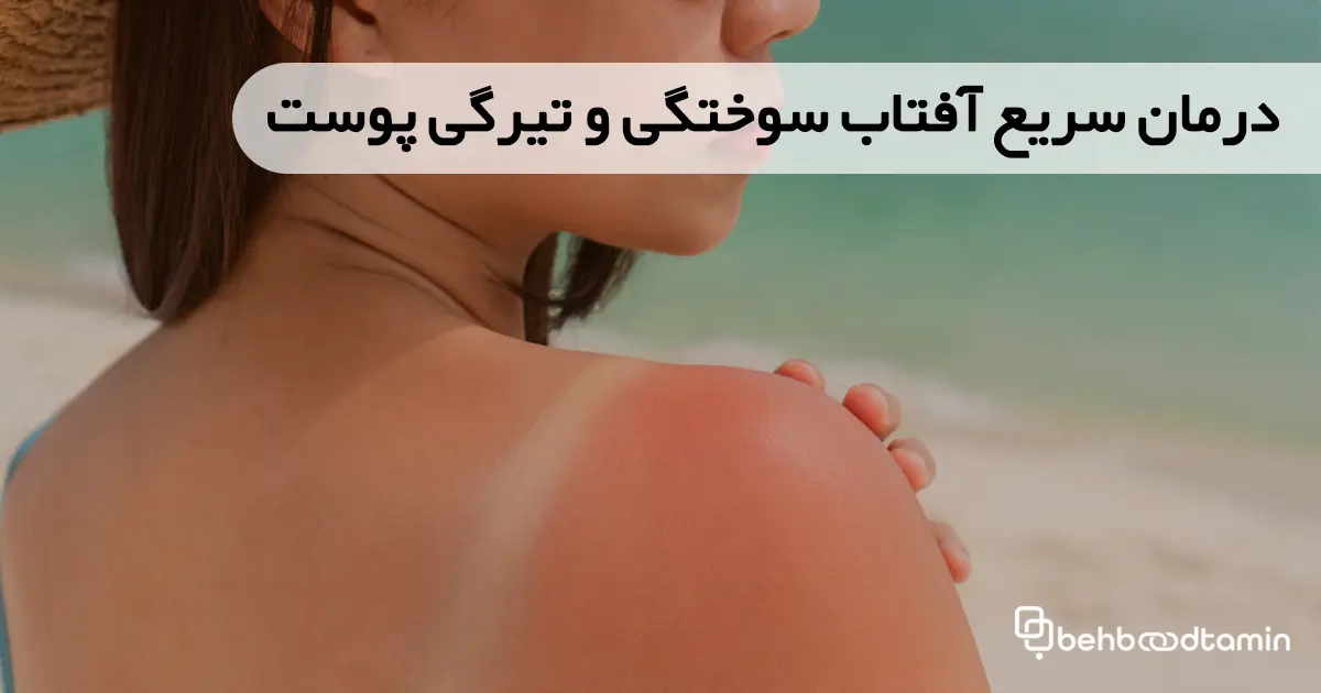 درمان سریع آفتاب سوختگی و تیرگی پوست