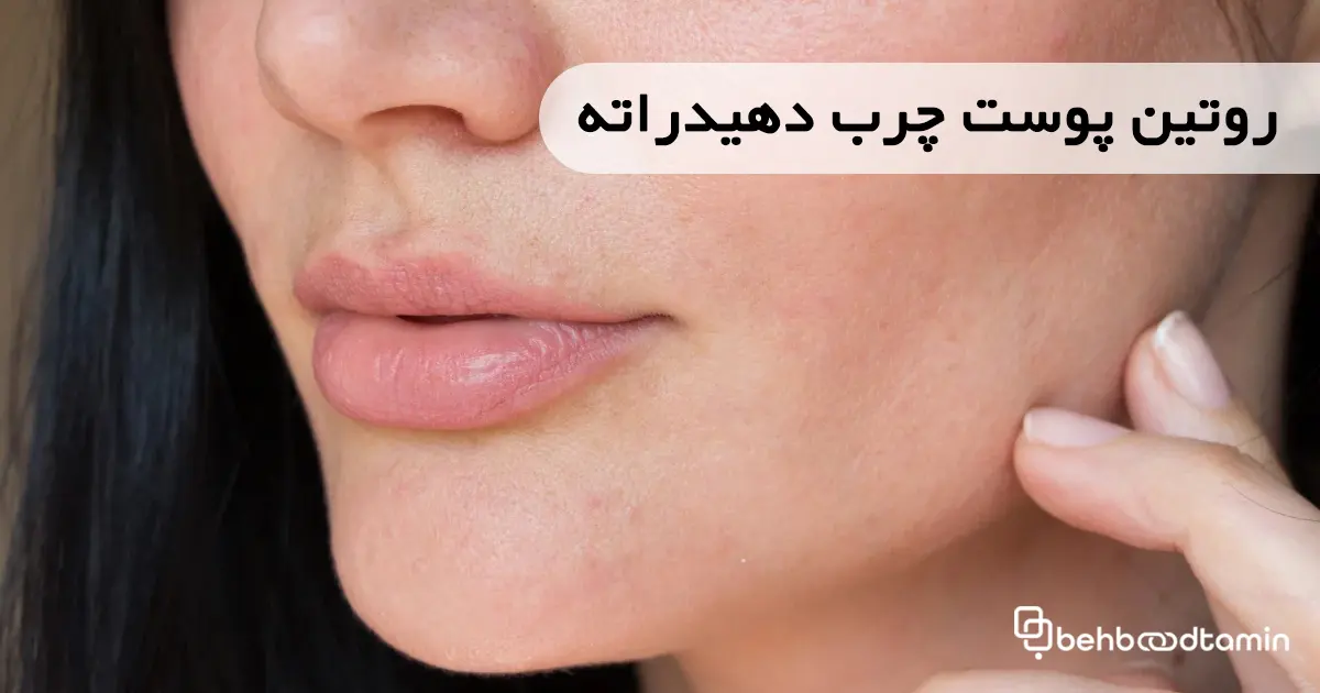 روتین پوست چرب دهیدراته