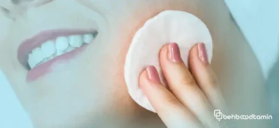 دلایل ایجاد جوش پس از استفاده از تونر