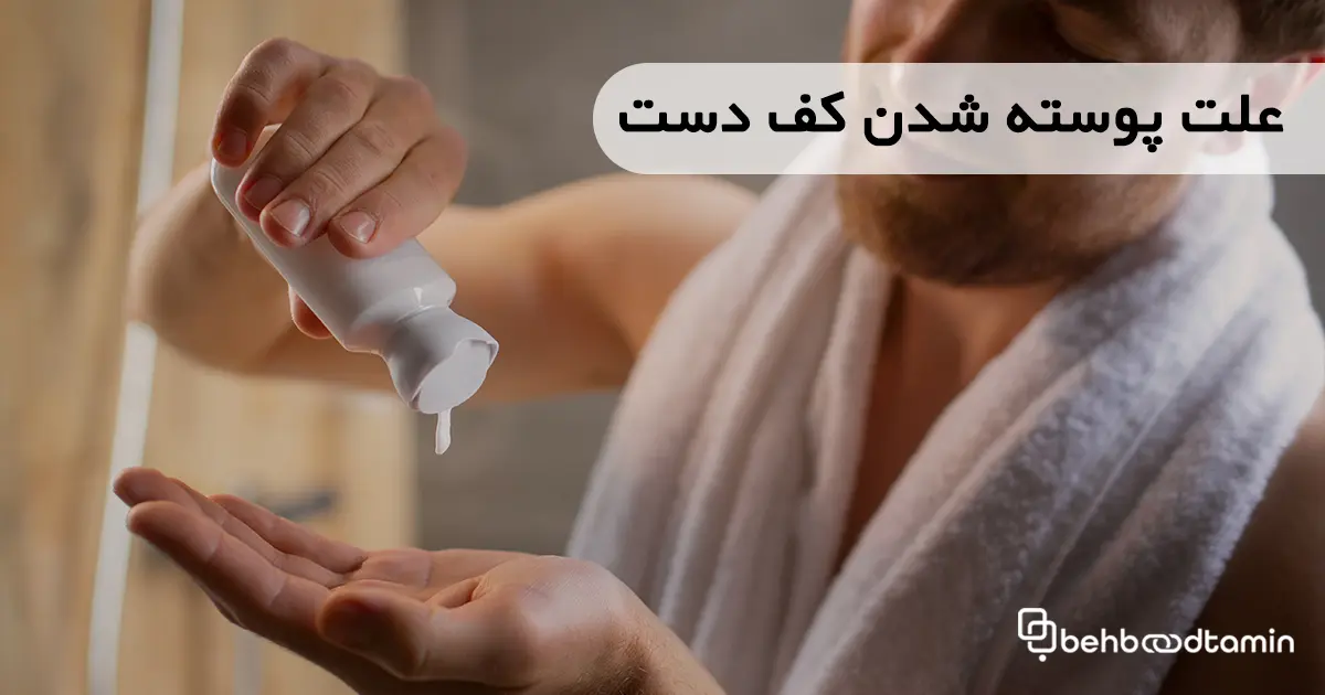 علت پوسته شدن کف دست