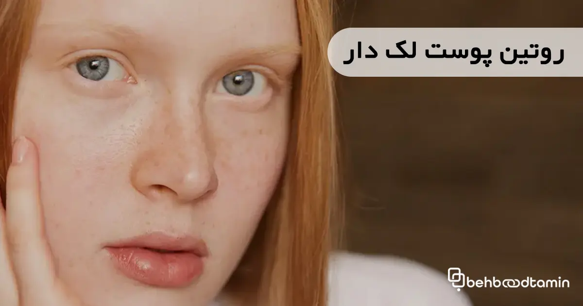 روتین پوست لک دار