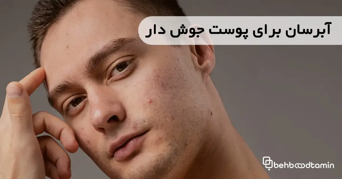 آبرسان برای پوست جوش‌دار