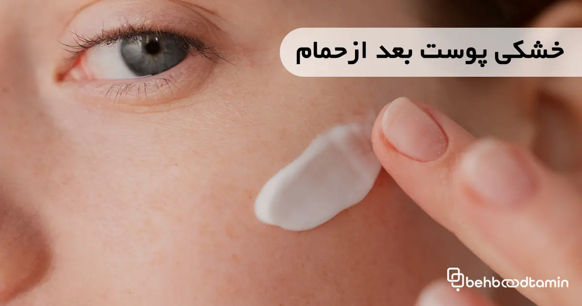 خشکی پوست بعد از حمام