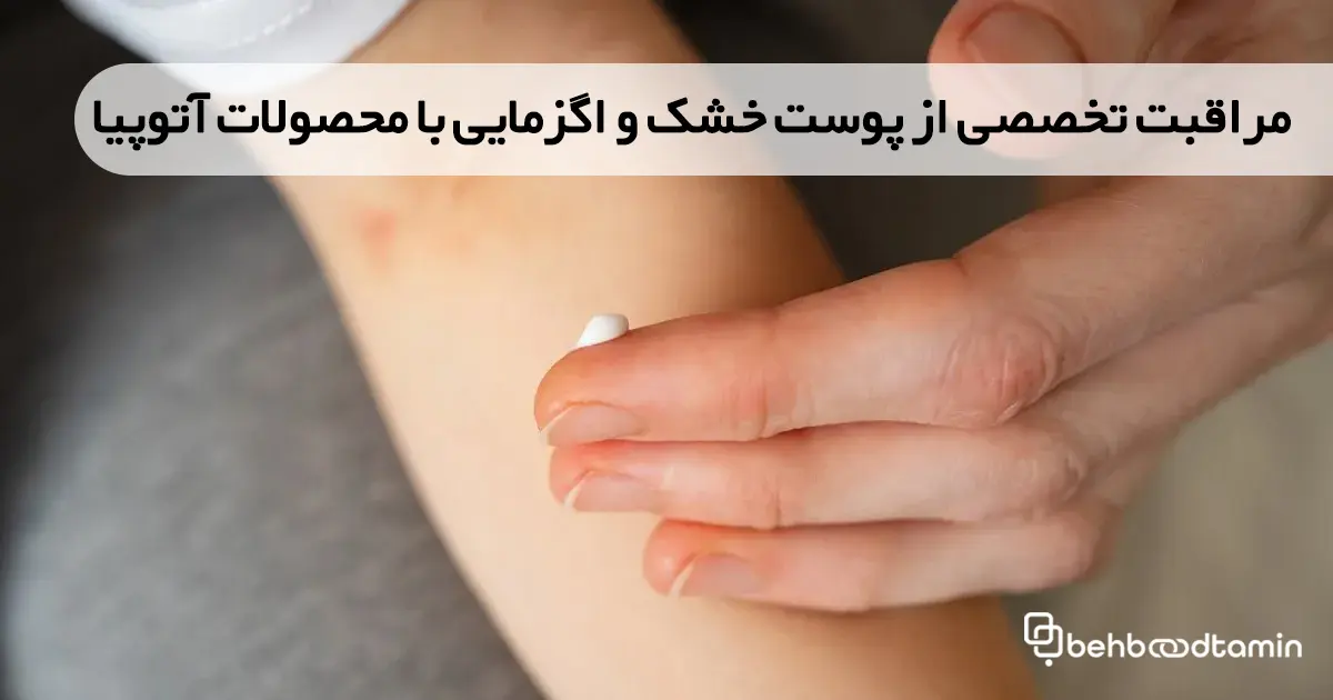 مراقبت تخصصی از پوست خشک و اگزمایی با محصولات آتوپیا