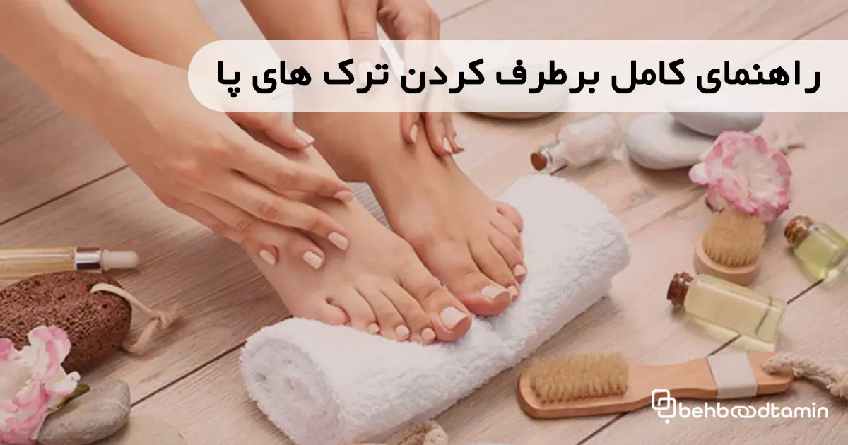 راهنمای کامل برطرف کردن ترک های پا