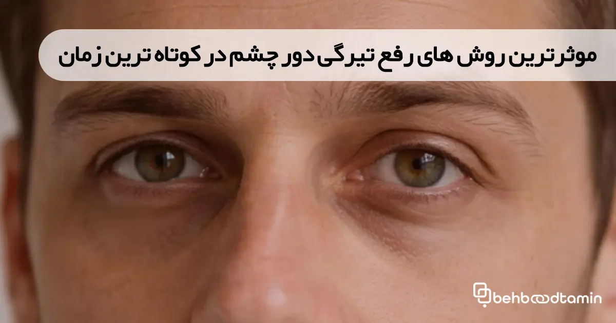 موثرترین روش های رفع تیرگی دور چشم در کوتاه ترین زمان