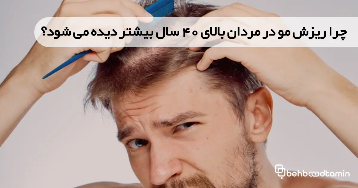 چرا ریزش مو در مردان بالای 40 سال بیشتر دیده می شود؟