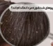 بهترین شامپوهای ضدشوره مردانه کدام اند؟