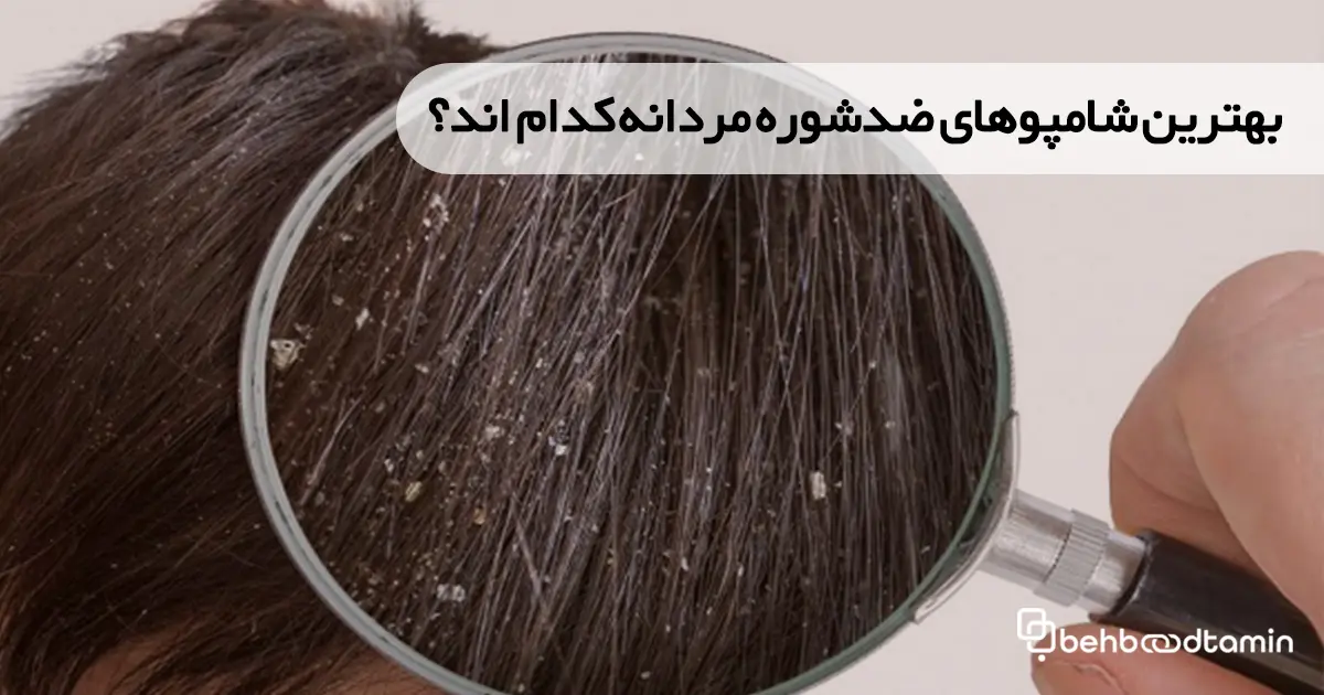 بهترین شامپوهای ضدشوره مردانه کدام اند؟