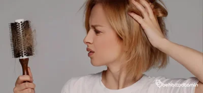 دلایل اصلی ریزش مو در خانم ها و آقایان