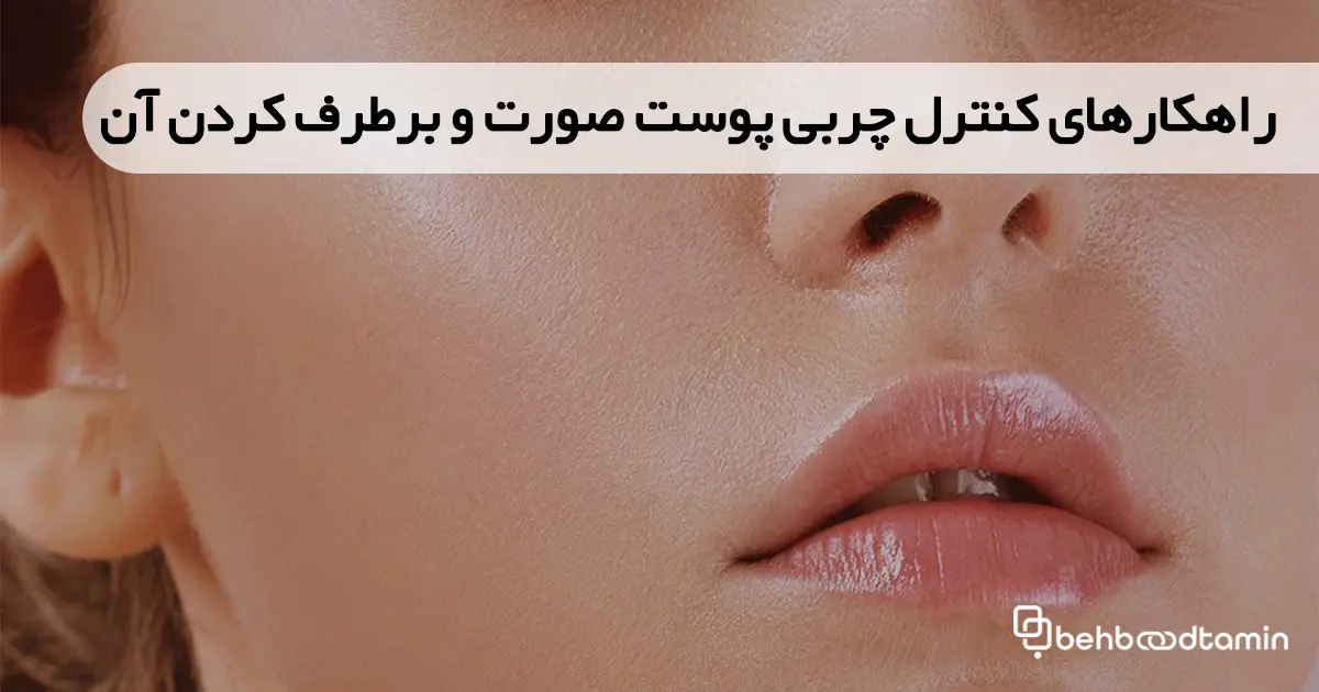 راهکارهای کنترل چربی پوست صورت و برطرف کردن آن