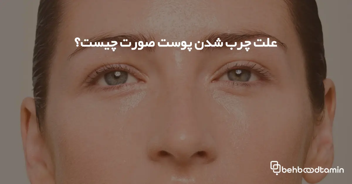 علت چرب شدن پوست صورت چیست؟