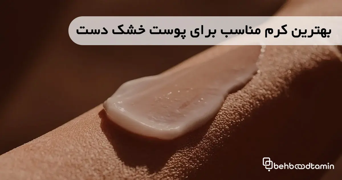 بهترین کرم مناسب برای پوست خشک دست