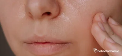 دلایل چرب شدن پوست صورت