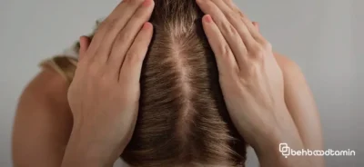  تاثیرات چای سبز بر کاهش ریزش مو