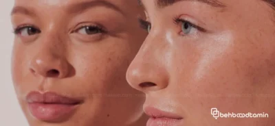 چگونه با سبک زندگی سالم تعادل طبیعی پوست را احیا کنیم؟