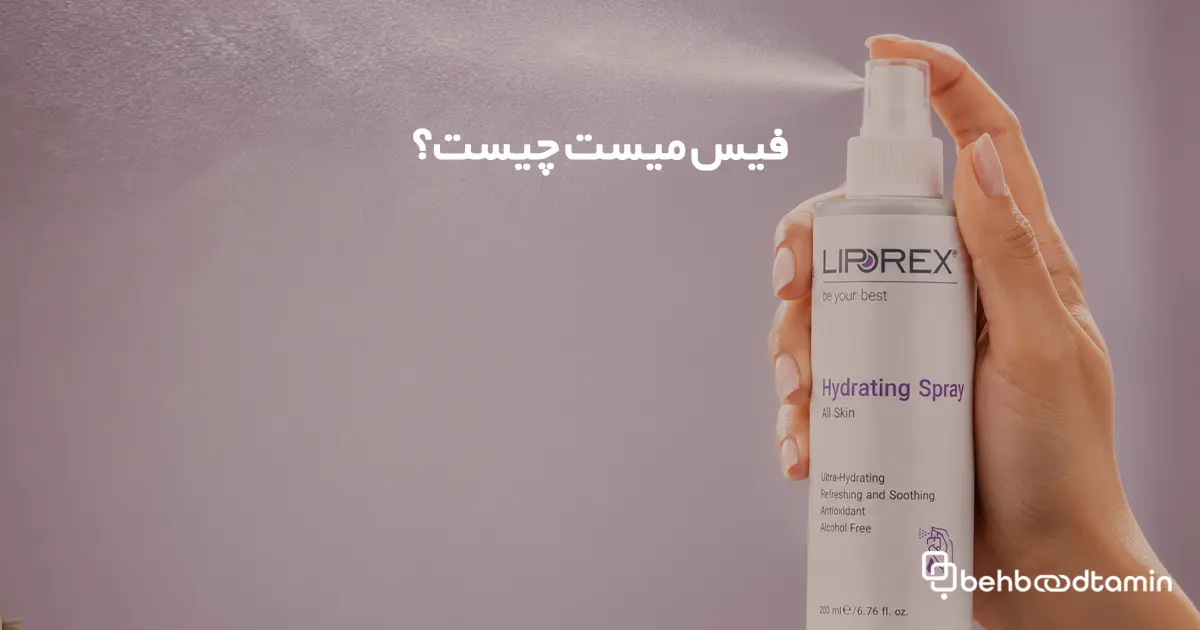 فیس میست چیست؟