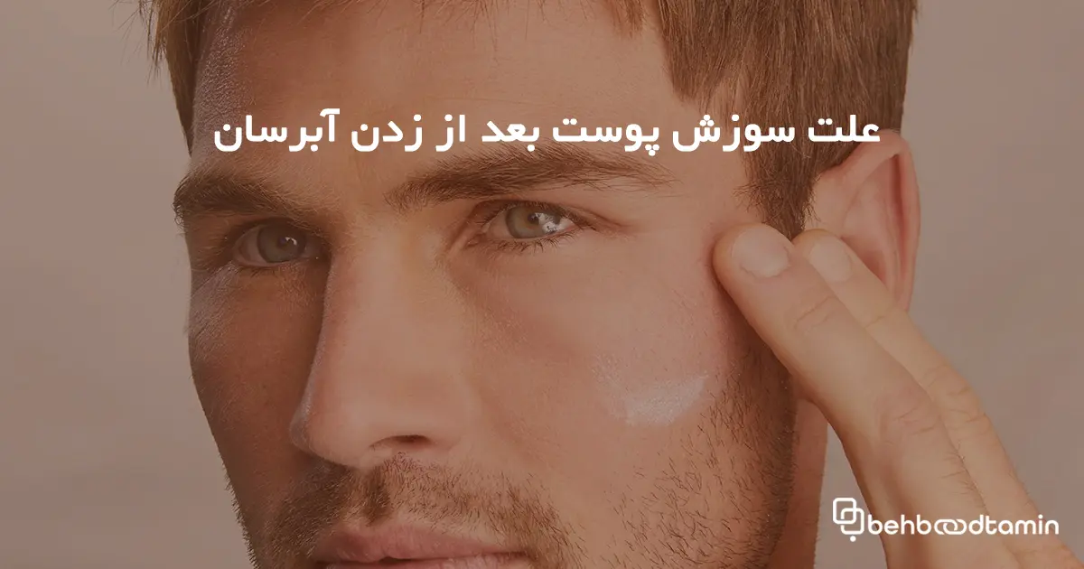 علت سوزش پوست بعد از زدن آبرسان