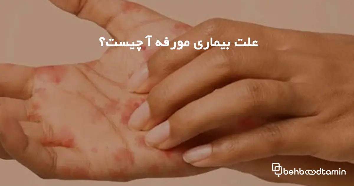 علت بیماری مورفه آ چیست؟