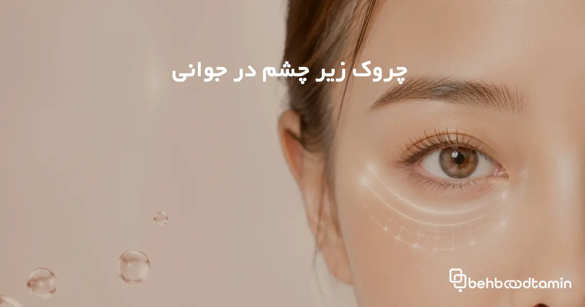 چروک زیر چشم در جوانی