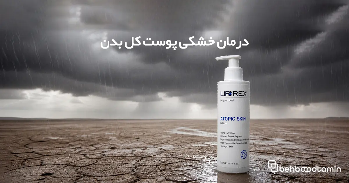 درمان خشکی پوست کل بدن