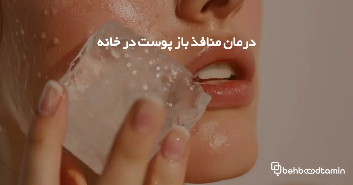 درمان منافذ باز پوست در خانه