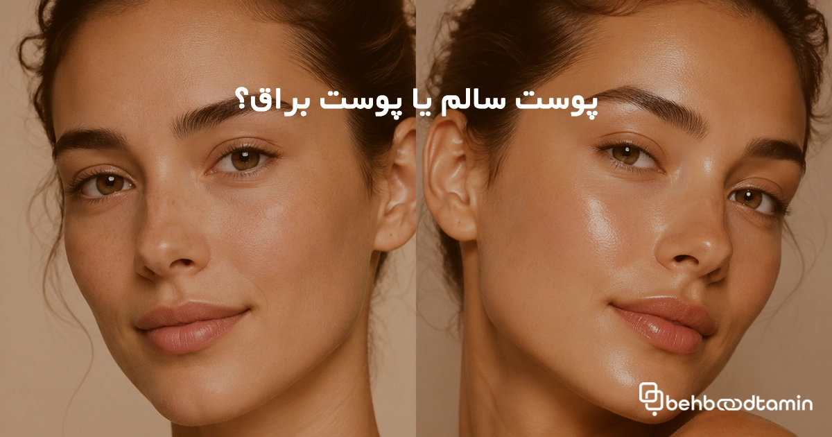 پوست سالم یا پوست براق؟