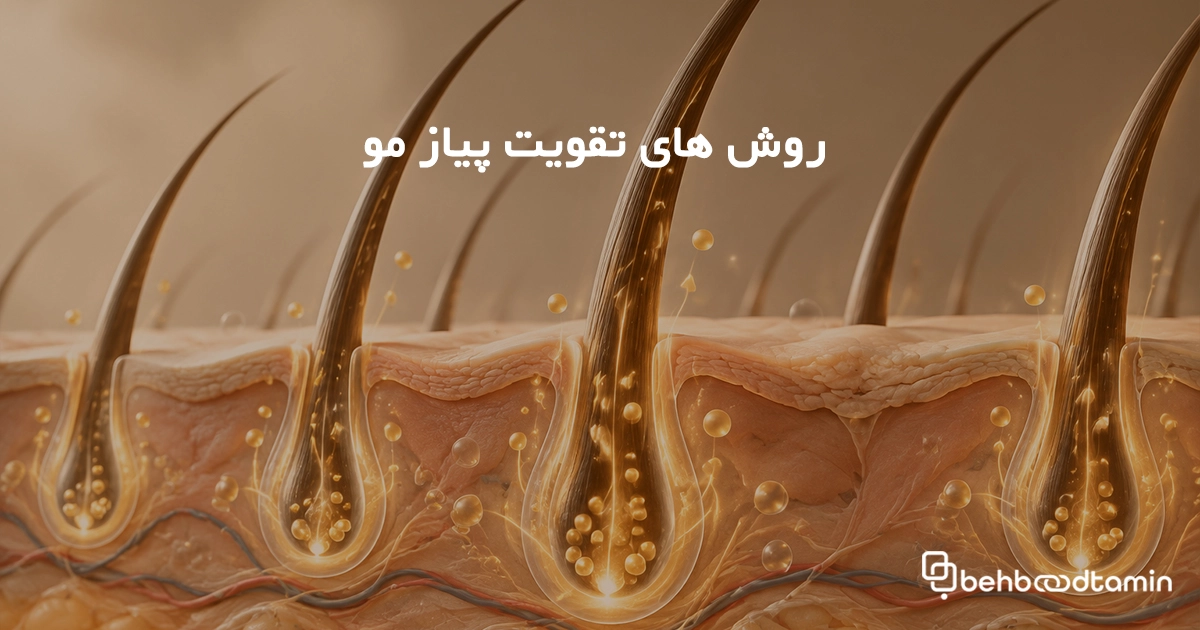 روش های تقویت پیاز مو